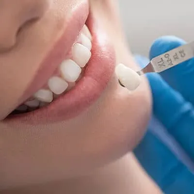 Coroa Dentaria Imagem